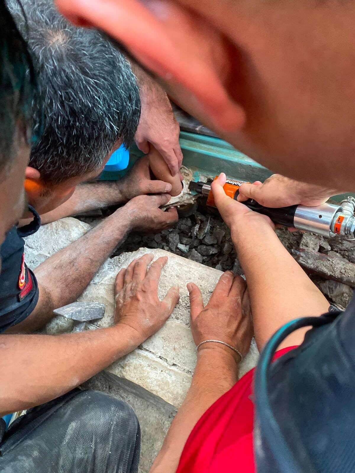 Muğla’da Havuzda Korku Dolu Anlar: 4 Yaşındaki Çocuğun Kolu Emiş Borusuna Sıkıştı 3
